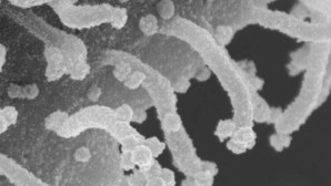 Koronavirüs hücresinin yeni fotoğrafı ortaya çıktı